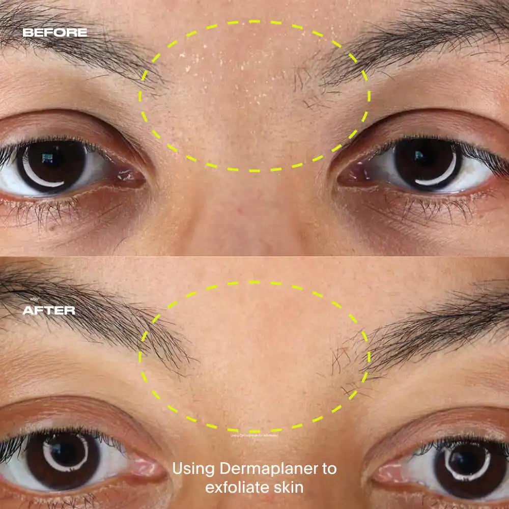 Dermaplaner Kit, Mercury